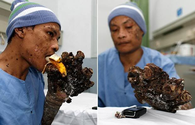 tree man feet. tree man feet. tree man feet. his hands and feet removed; his hands